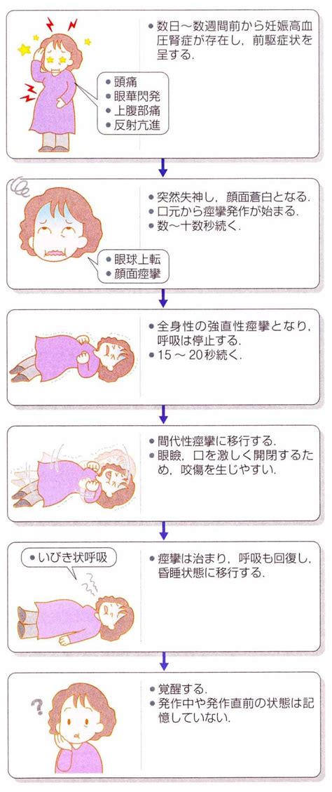 腟痙攣|腟けいれん（女性の病気と妊娠・出産｜外陰と腟の病気）と